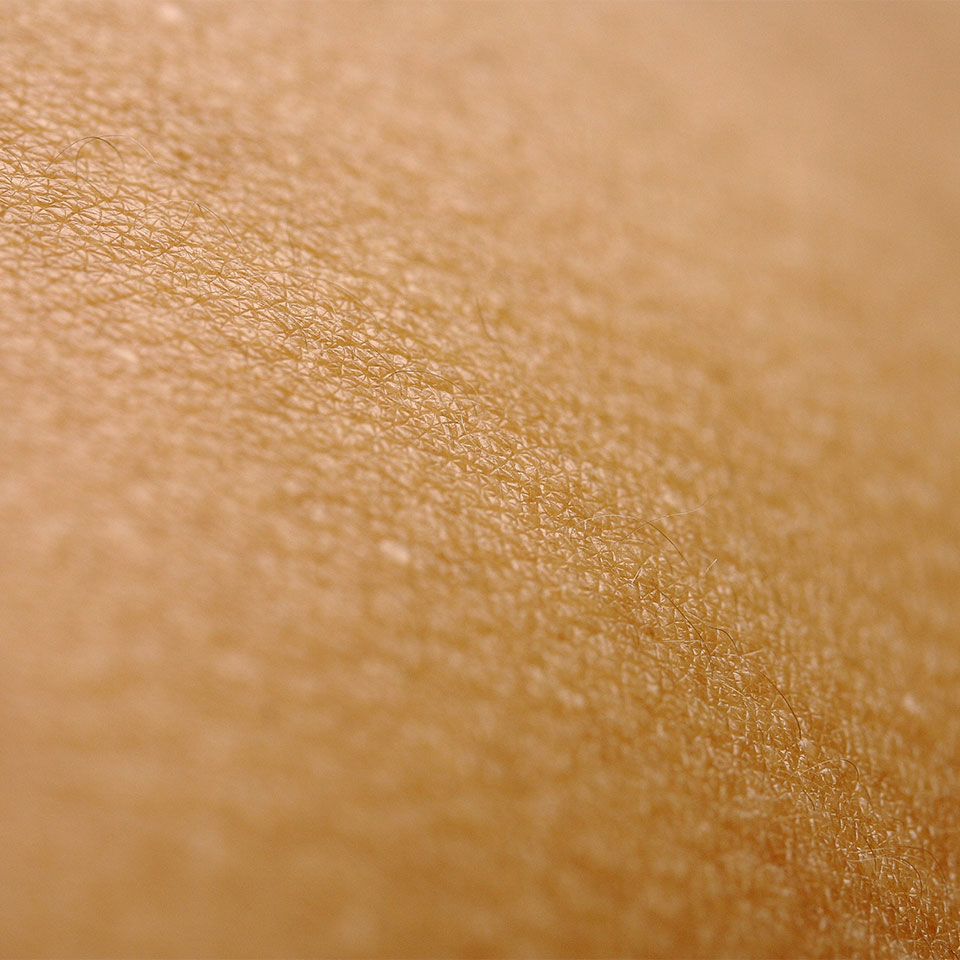 cryo body contouring
