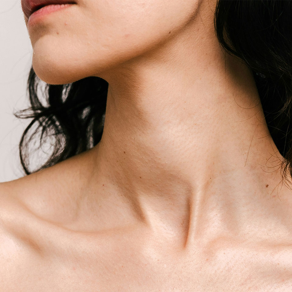 cryo body contouring