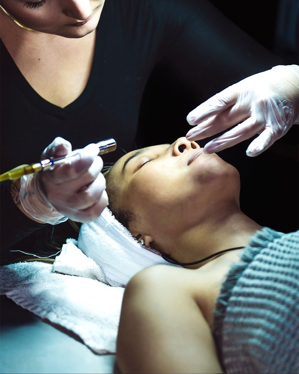 microdermabrasion near me